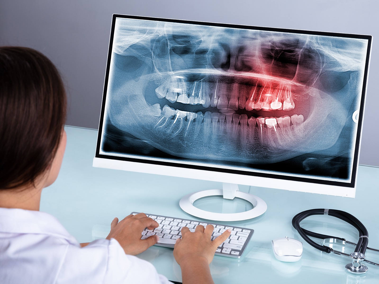 Why Do Dentists take Dental X-Rays?