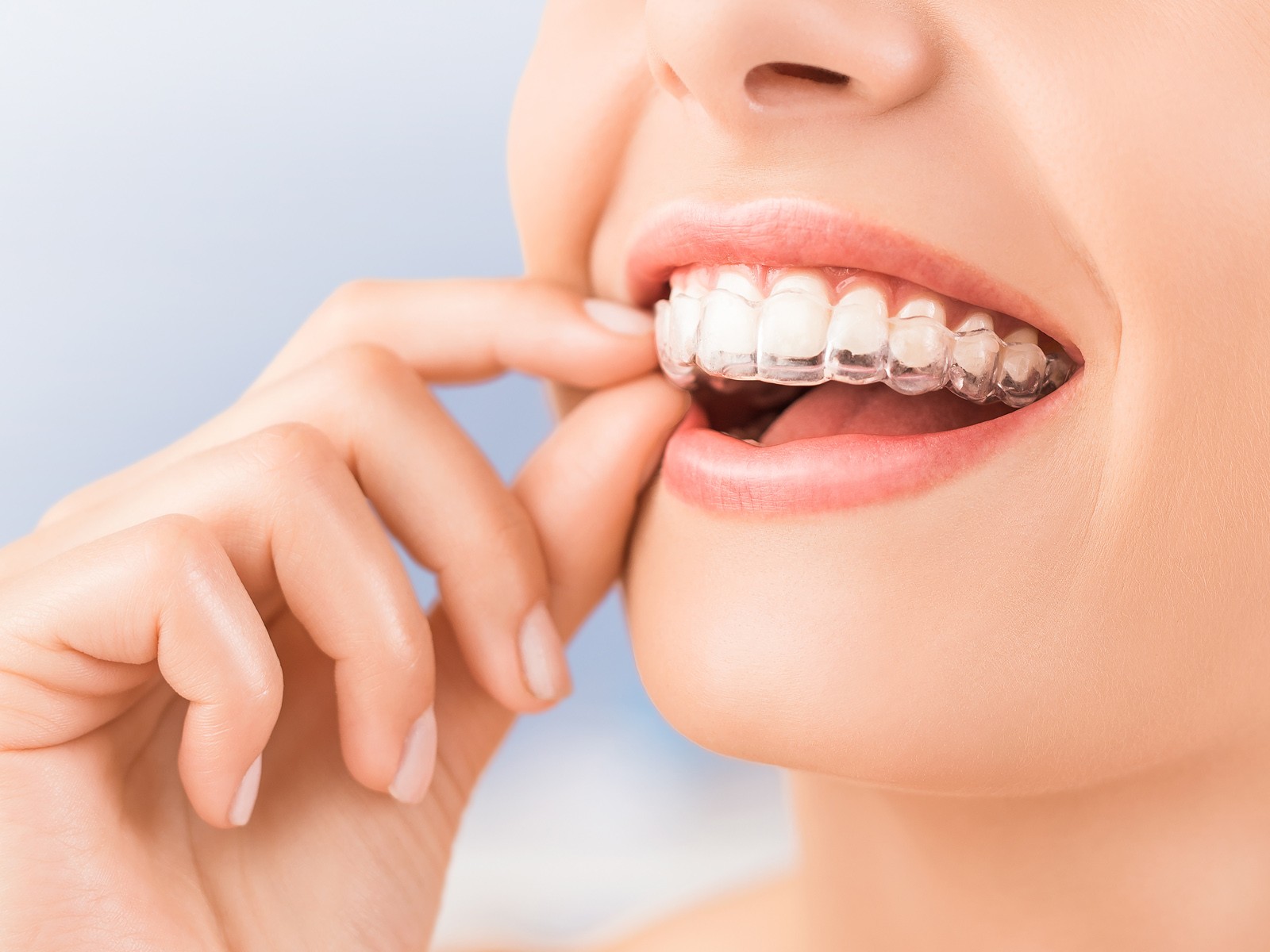 Why Isn’t Invisalign Right For Everyone?