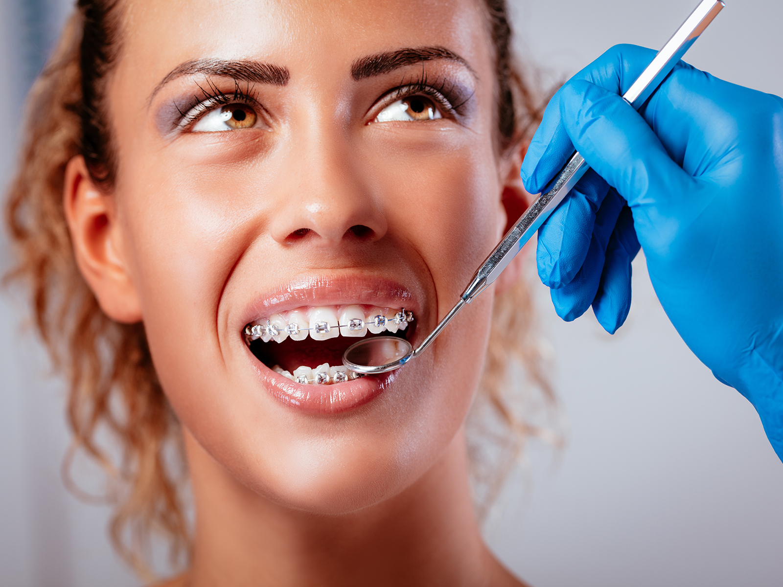 How Do Braces Work To Straighten Your Teeth?