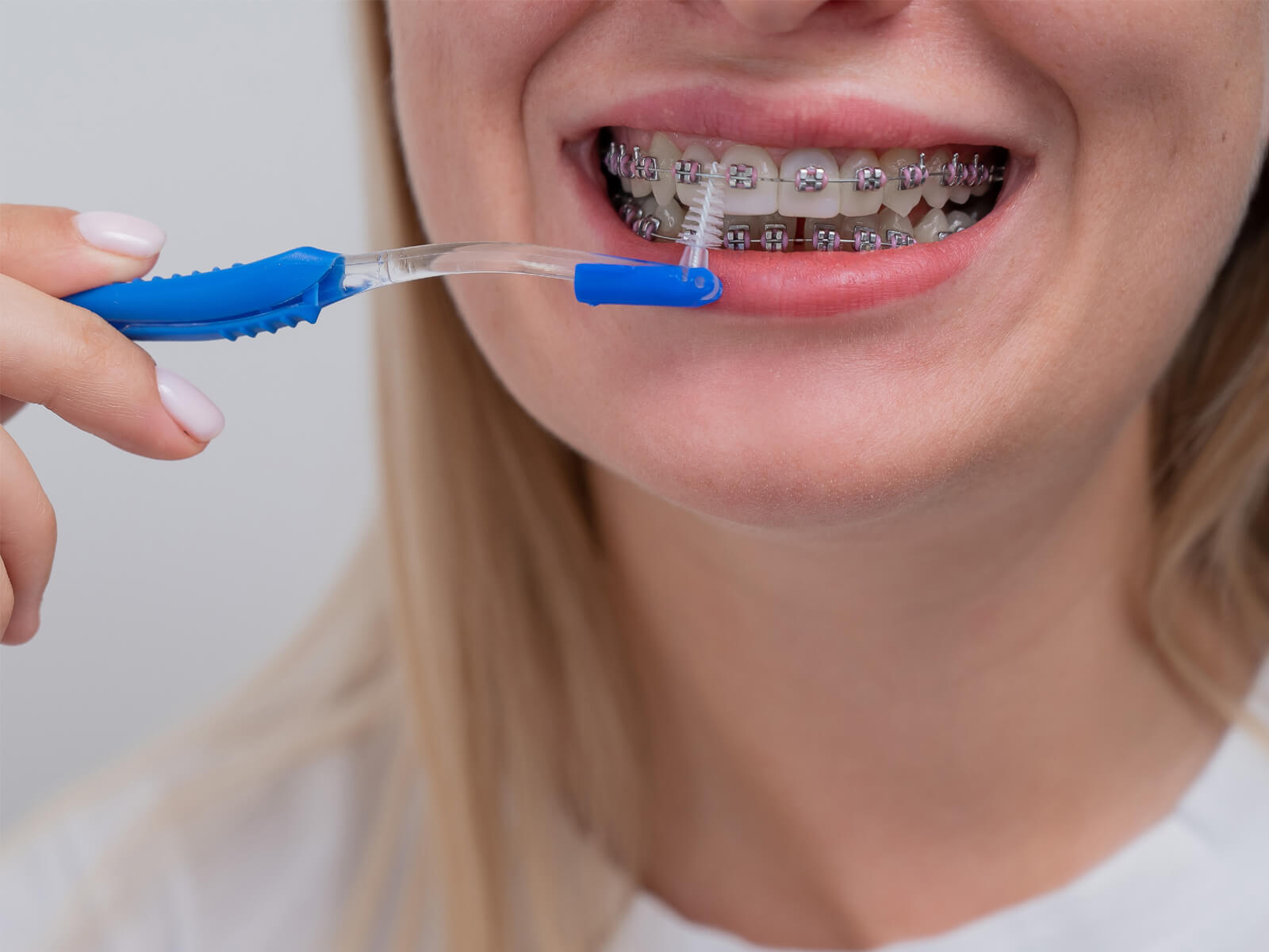 Common Flossing Mistakes To Avoid With Braces