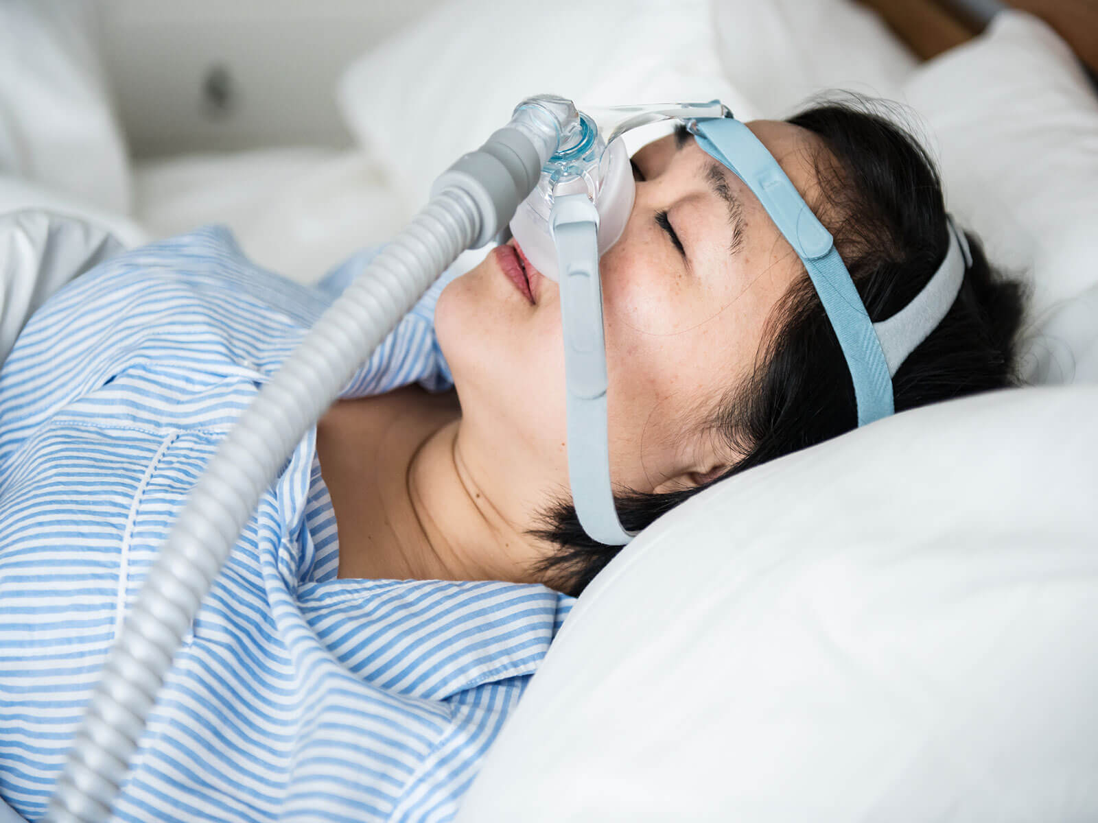 How Can Sleep Apnea Be Treated Without CPAP?