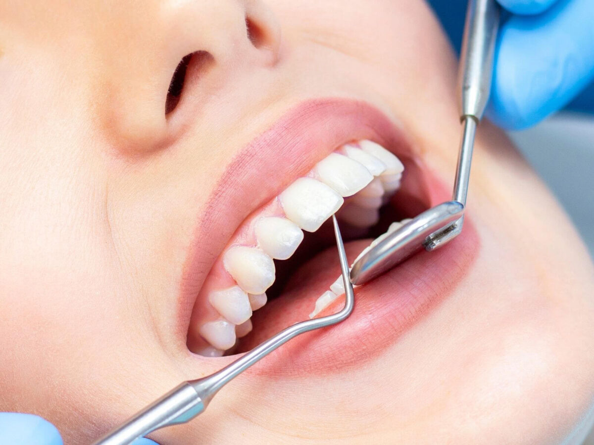 What Happens During A Routine Dental Cleaning?