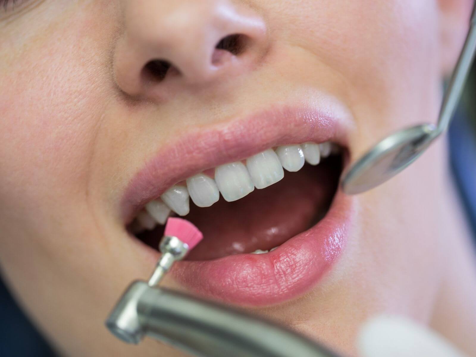 How Long Does a Teeth Cleaning Take? Time, Steps & What to Expect