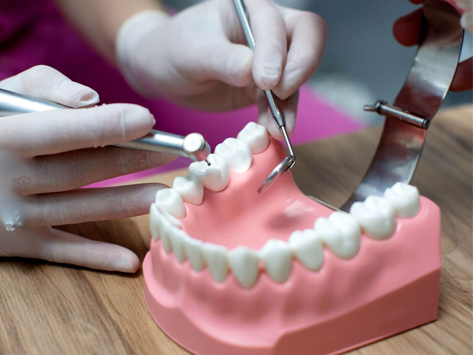 Dental Inlay vs. Filling: Differences, Cost, and Which Is Right for You?